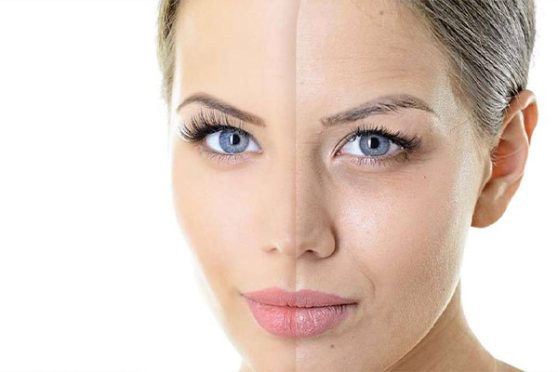 هایفو 7بعدی (اولترا فورمر)