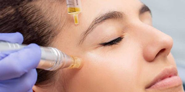 میکرونیدلینگ